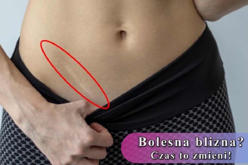 pole magnetyczne
